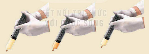 Thí nghiệm về ảnh hưởng của áp suất đến cân bằng hóa học