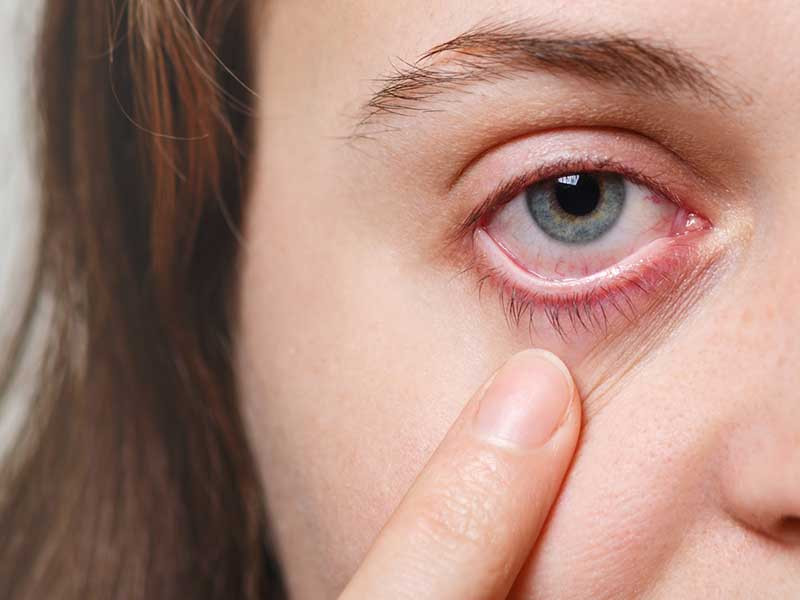 Độ ẩm và bệnh hô hấp