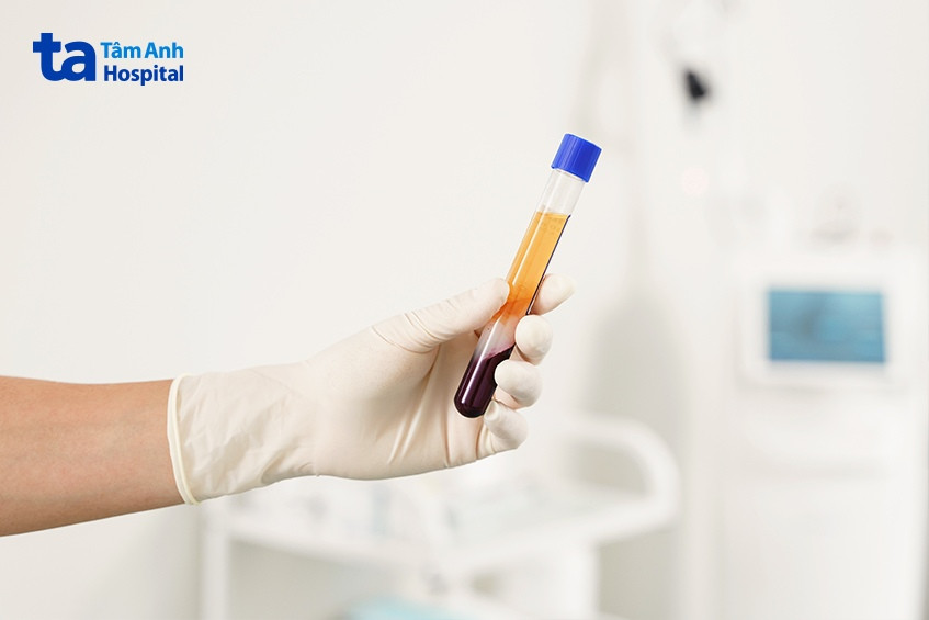 Bộ Golgi - Một phần quan trọng trong quá trình vận chuyển protein