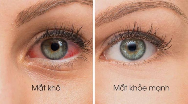 Kiểm soát độ ẩm trong nhà