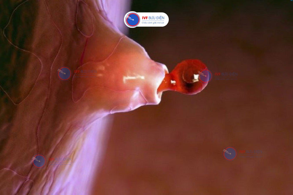 Mô tả quá trình phát triển của nang noãn từ nguyên thủy đến trưởng thành