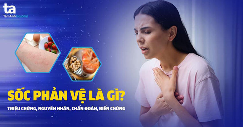 Định nghĩa tốc độ phản ứng